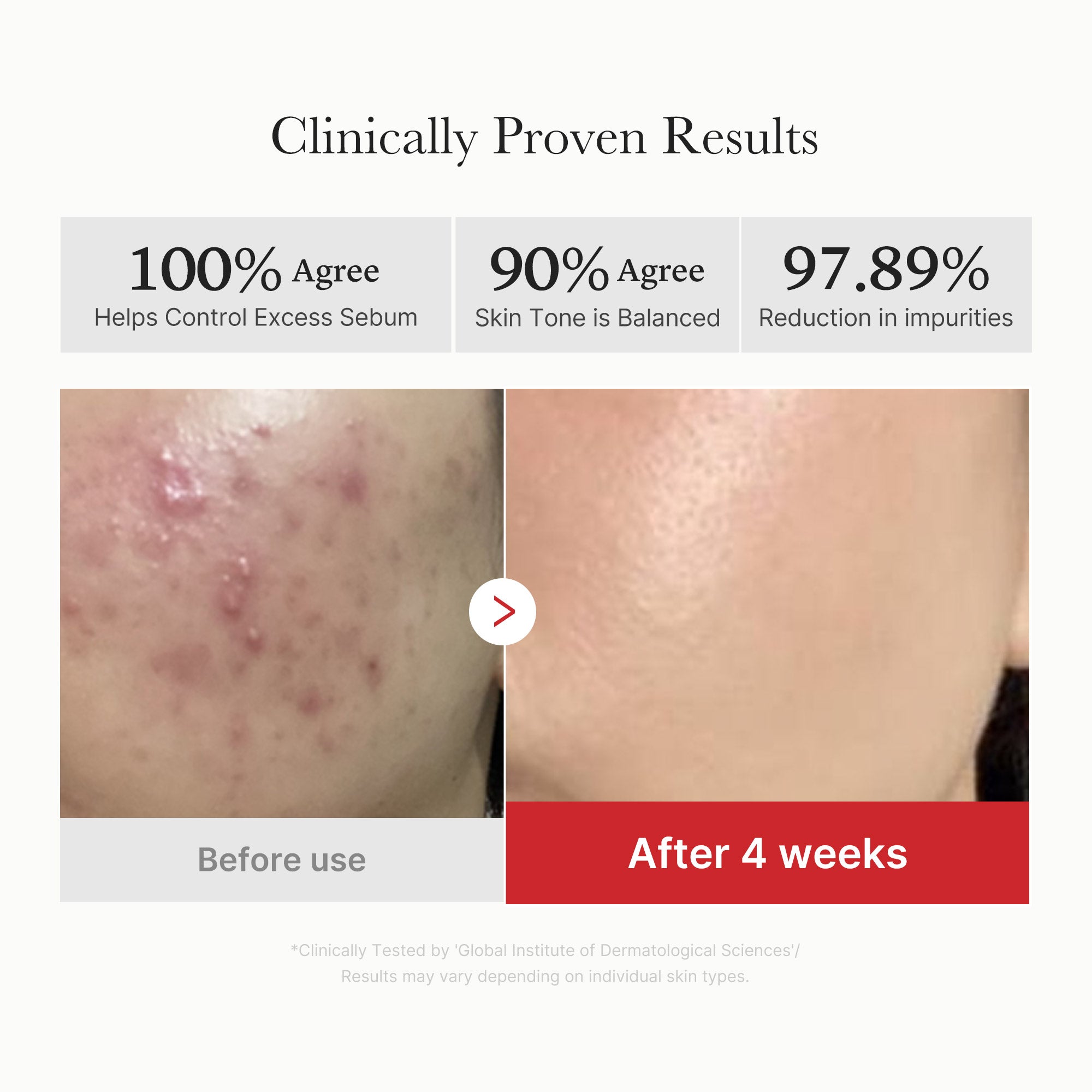 [Subscr.] Red Succinic Acid Panthenol Pads - medicube.us
