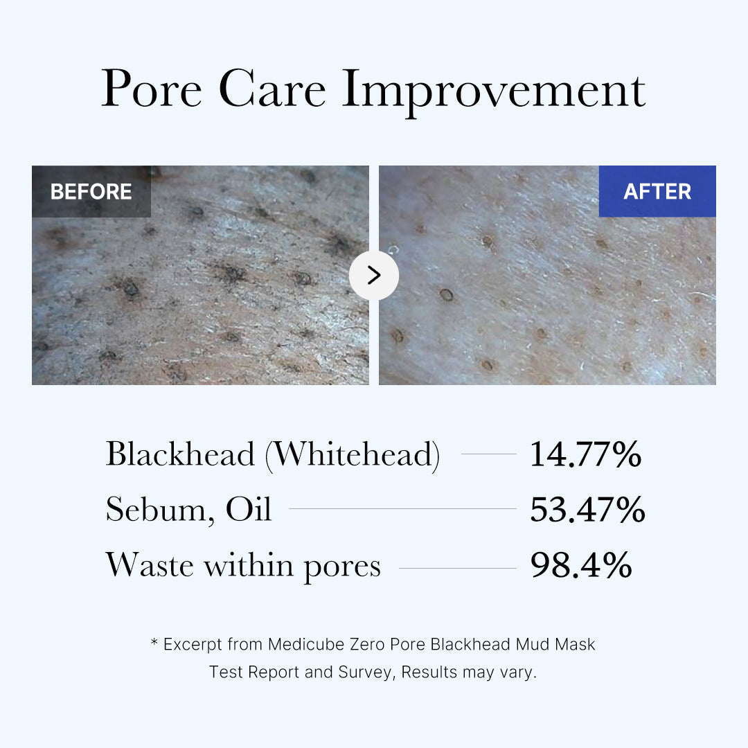 [Subscr.] Zero Pore Blackhead Mud Mask - medicube.us