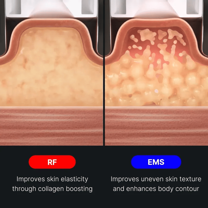 AGE-R Contour Body Shot - medicube.us
