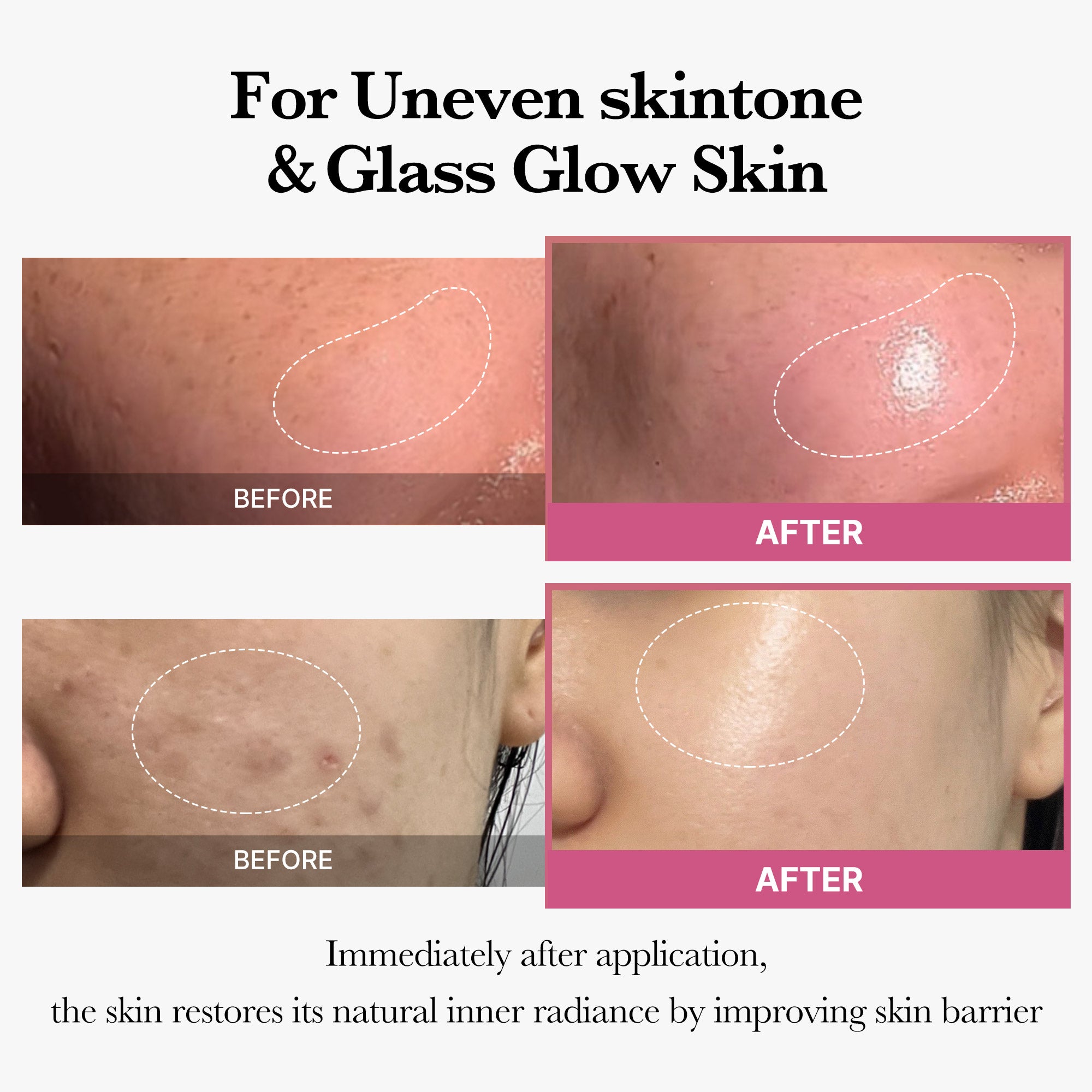 [Tati's Exclusive] All About Glow Set - medicube.us