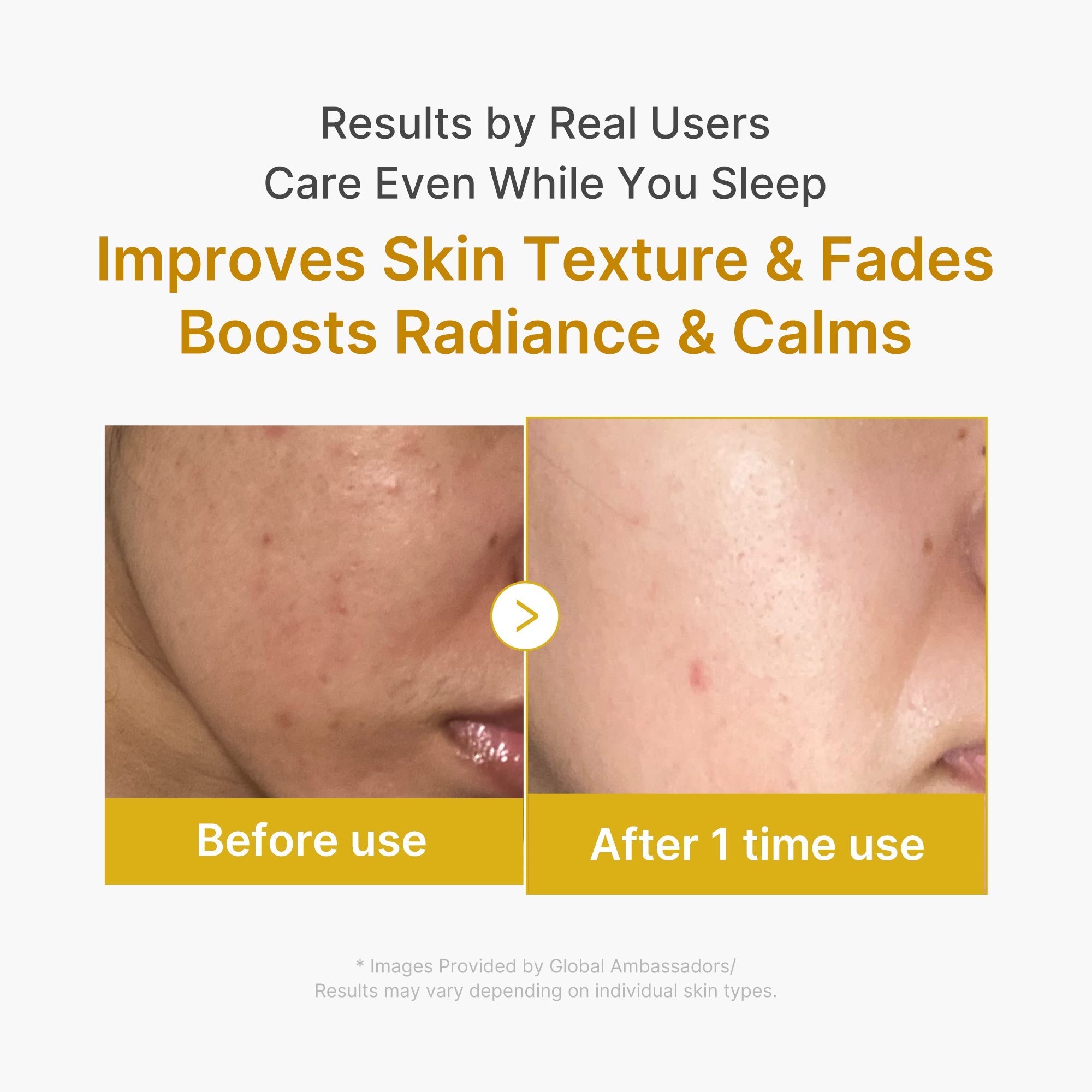 [GIFT] Kojic Acid Turmeric Overnight Wrapping Mask
